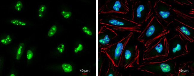 EXOSC5 Antibody in Immunocytochemistry (ICC/IF)