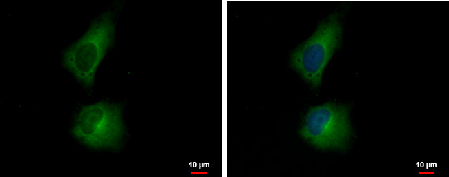 AAGAB Antibody in Immunocytochemistry (ICC/IF)