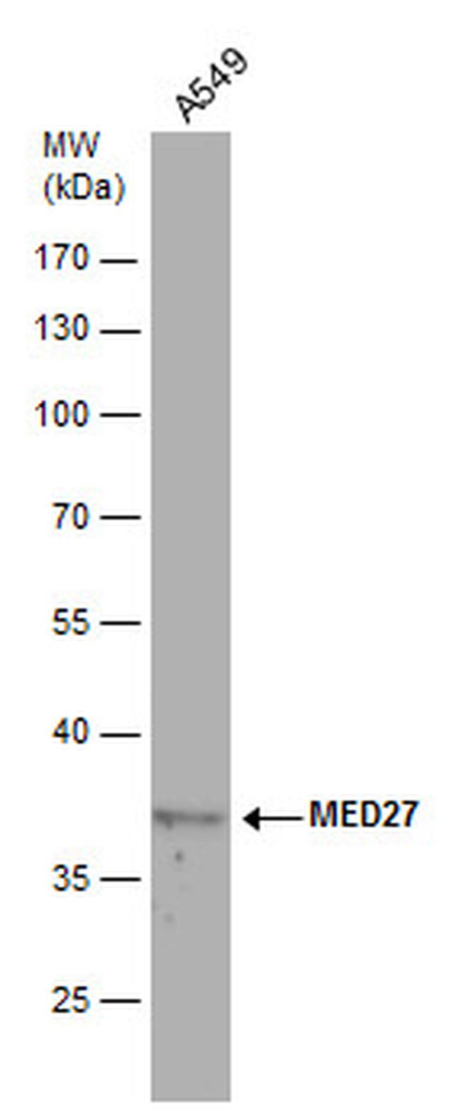 MED27 Antibody in Western Blot (WB)