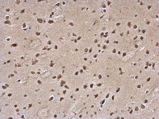 SLUG Antibody in Immunohistochemistry (Paraffin) (IHC (P))