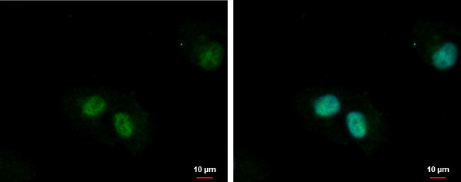 ZNF266 Antibody in Immunocytochemistry (ICC/IF)