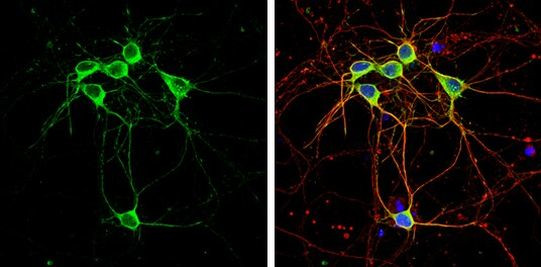 Phospho-CaMKII alpha (Thr286) Antibody in Immunocytochemistry (ICC/IF)