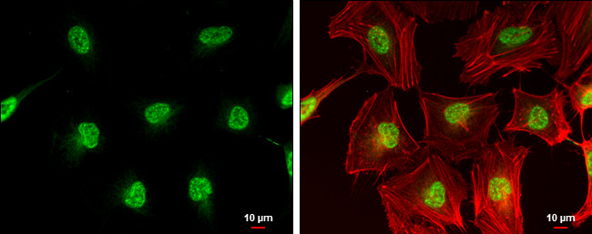 Cdc25C Antibody in Immunocytochemistry (ICC/IF)