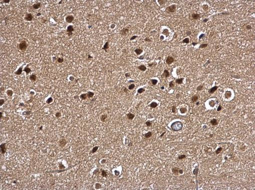 MYT1 Antibody in Immunohistochemistry (Paraffin) (IHC (P))