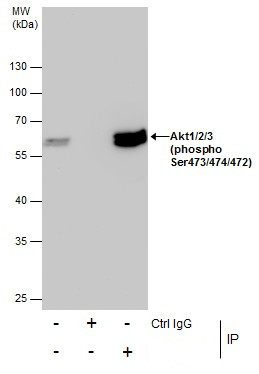 Phospho-AKT1 (Ser473) Antibody in Immunoprecipitation (IP)