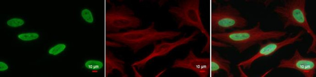 H2BK20ac Antibody in Immunocytochemistry (ICC/IF)