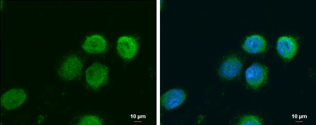 NAMPT Antibody in Immunocytochemistry (ICC/IF)