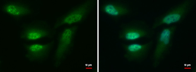 CDR2 Antibody in Immunocytochemistry (ICC/IF)