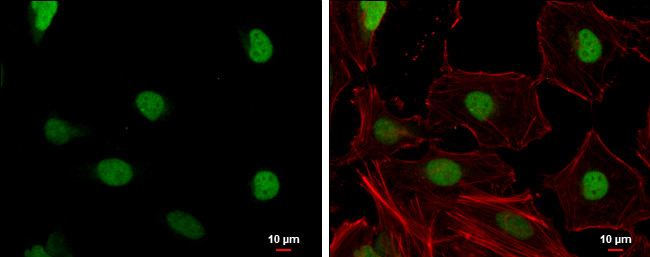 Claspin Antibody in Immunocytochemistry (ICC/IF)