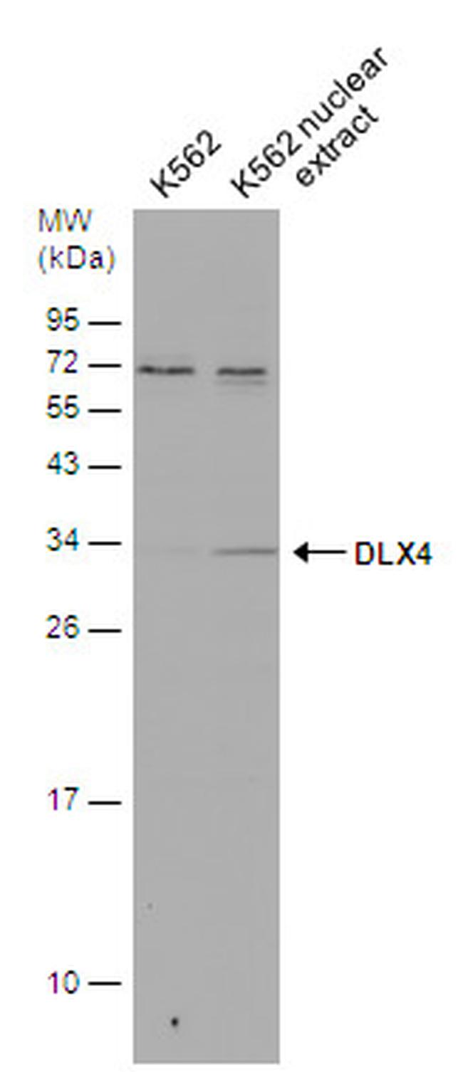 DLX4 Antibody in Western Blot (WB)