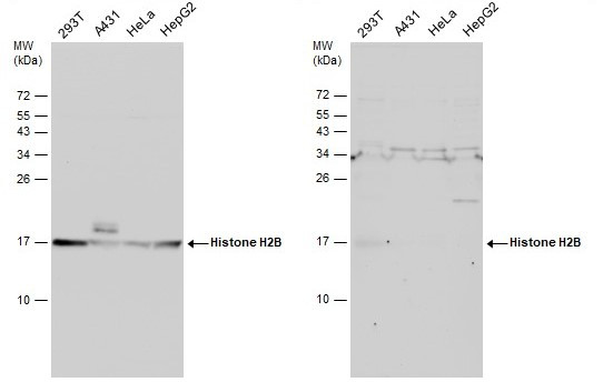 Histone H2B Antibody in Western Blot (WB)