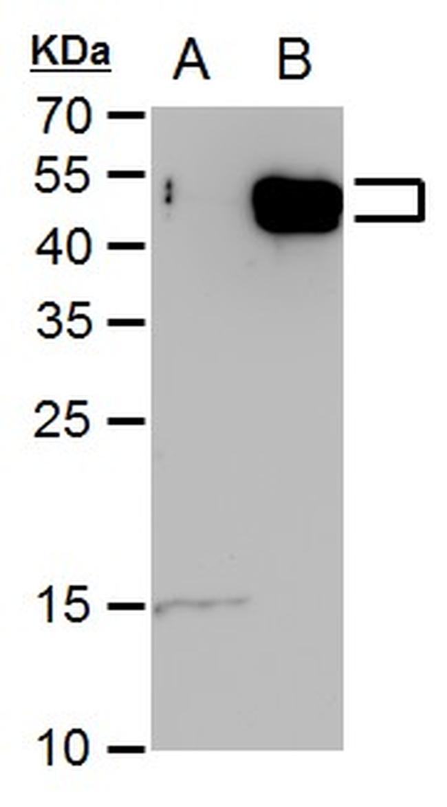 E2F5 Antibody in Western Blot (WB)