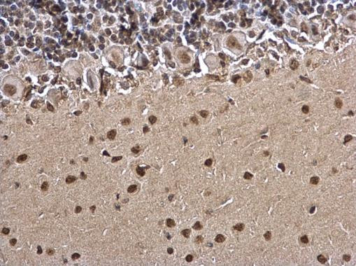 Histone H3 Antibody in Immunohistochemistry (Paraffin) (IHC (P))