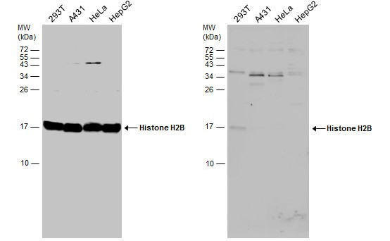 Histone H2B Antibody in Western Blot (WB)