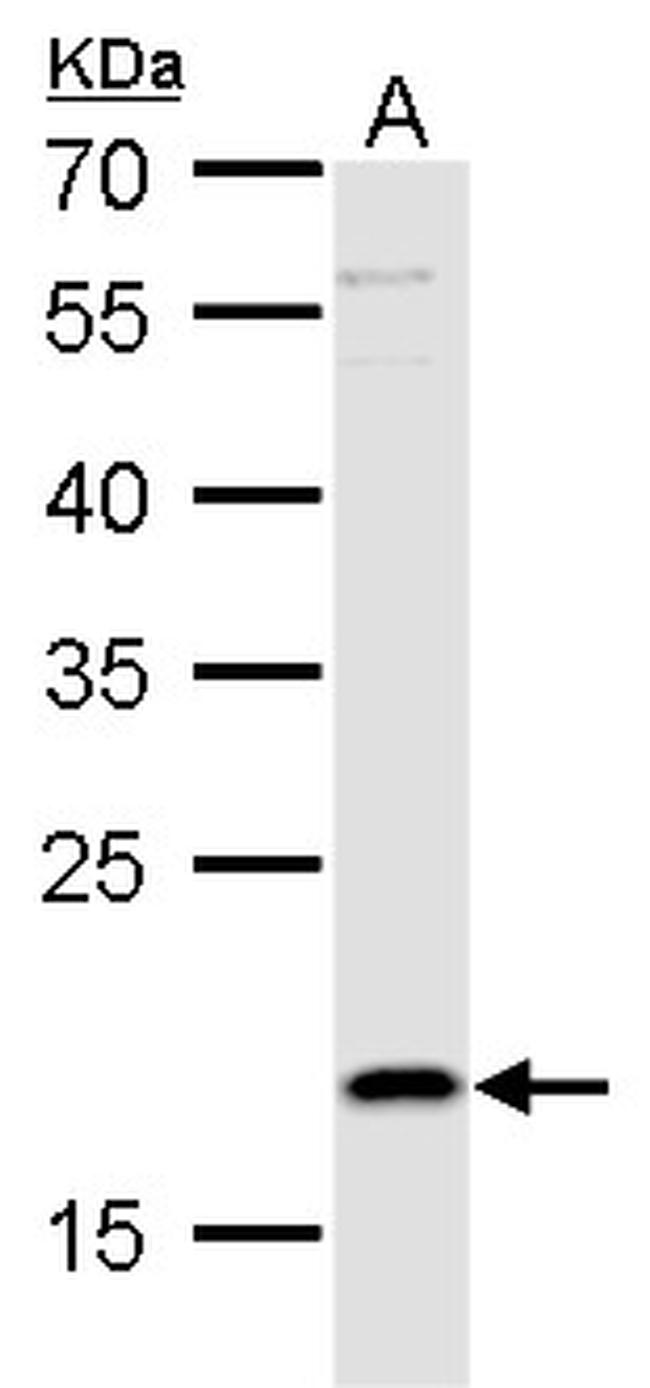 TSLP Antibody in Western Blot (WB)