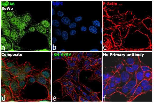 GATA6 Antibody in Immunocytochemistry (ICC/IF)
