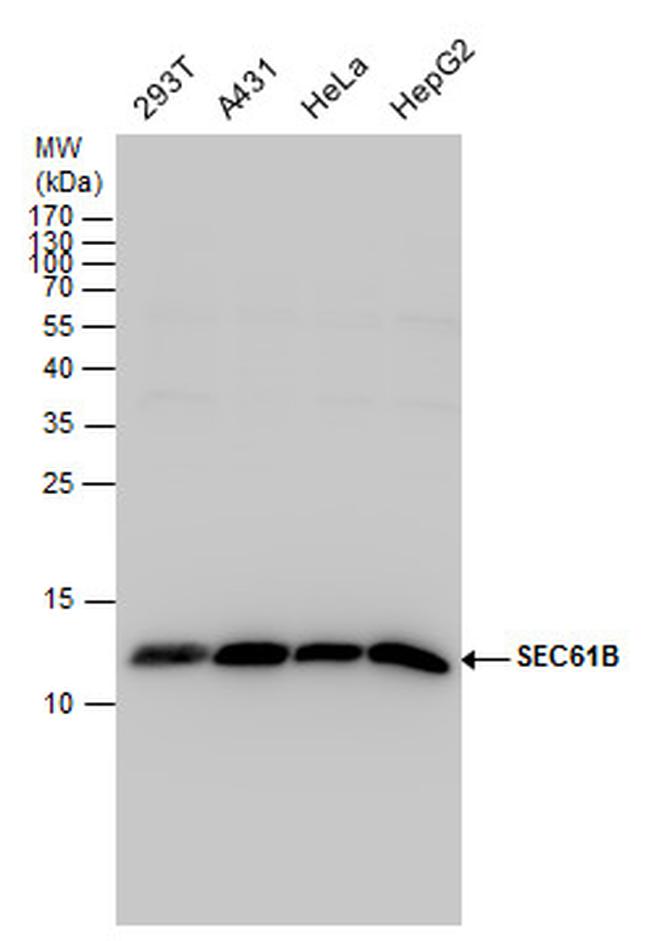 SEC61B Polyclonal Antibody (PA5-85603)