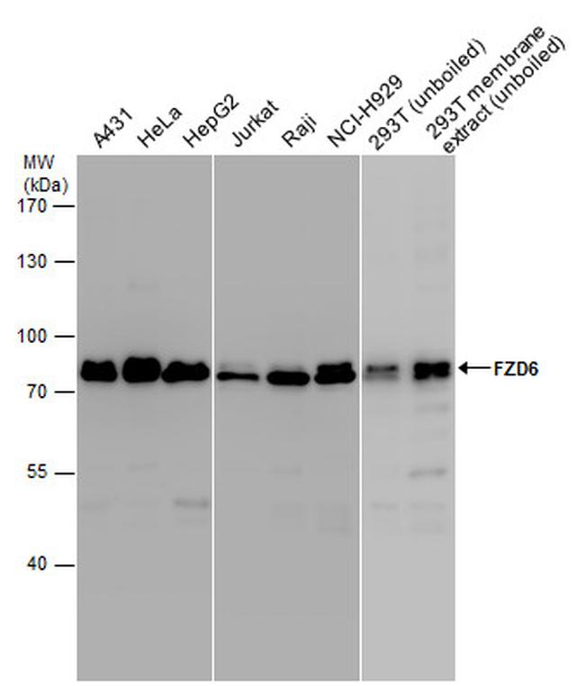 FZD6 Antibody in Western Blot (WB)