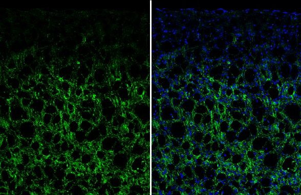 VIP Antibody in Immunohistochemistry (Frozen) (IHC (F))