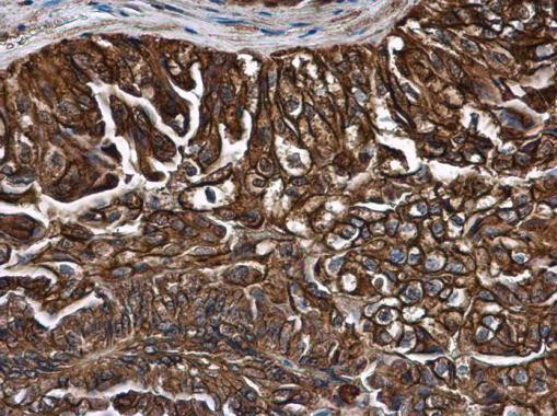Leptin Receptor Antibody in Immunohistochemistry (Paraffin) (IHC (P))