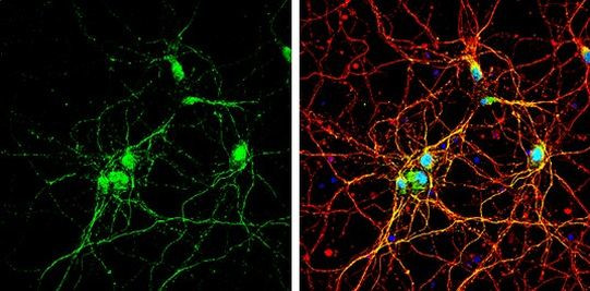 SSTR3 Antibody in Immunocytochemistry (ICC/IF)