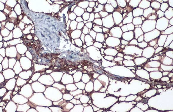 Perilipin 1 Antibody in Immunohistochemistry (Paraffin) (IHC (P))