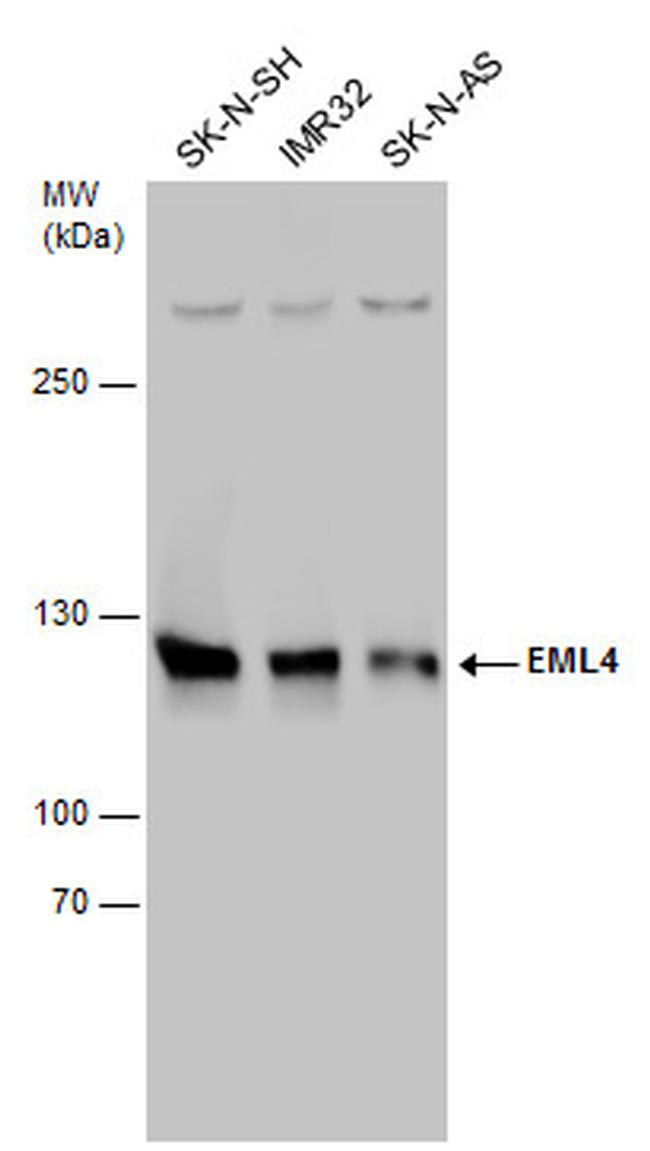 EML4 Antibody in Western Blot (WB)
