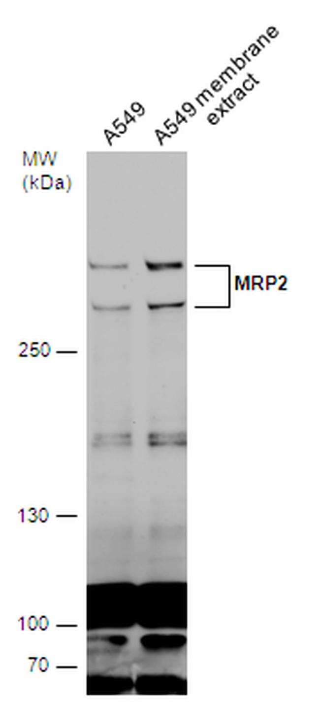 MRP2 Antibody in Western Blot (WB)