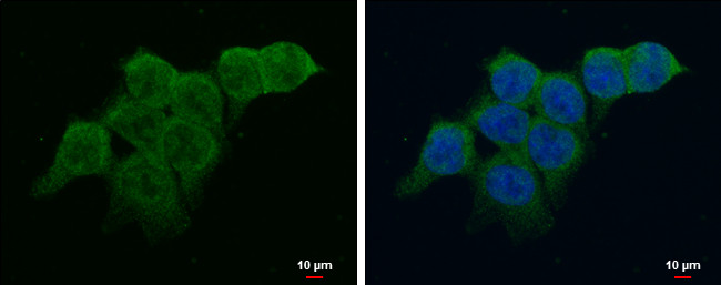 Ataxin 2 Antibody in Immunocytochemistry (ICC/IF)