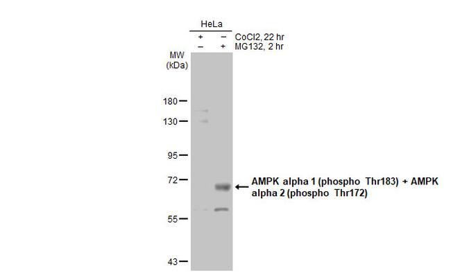 Phospho-AMPK alpha-1,2 (Thr172, Thr183) Antibody in Western Blot (WB)