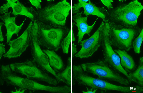 S6 Antibody in Immunocytochemistry (ICC/IF)
