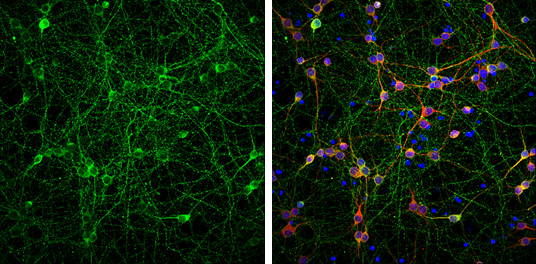 Phospho-Tau (Ser262) Antibody in Immunocytochemistry (ICC/IF)