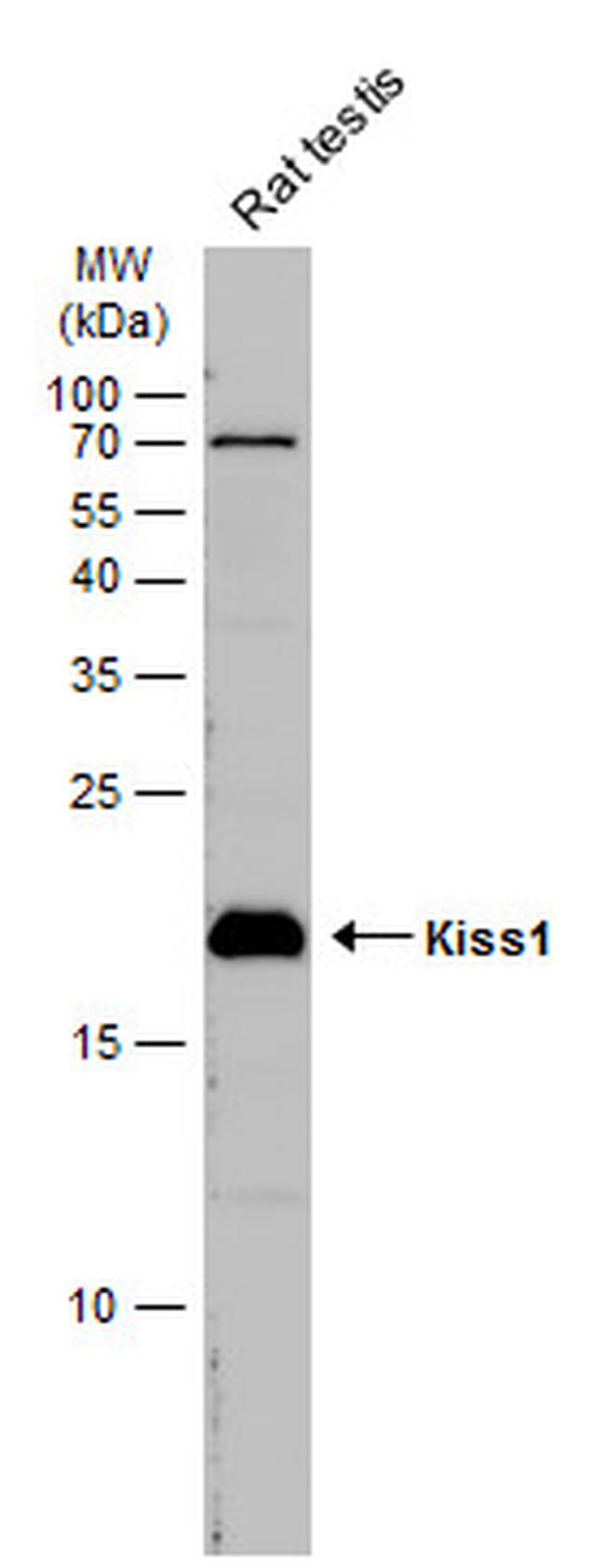 KISS1 Antibody in Western Blot (WB)