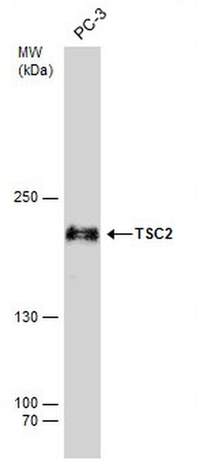Phospho-TSC2 (Ser939) Antibody in Western Blot (WB)