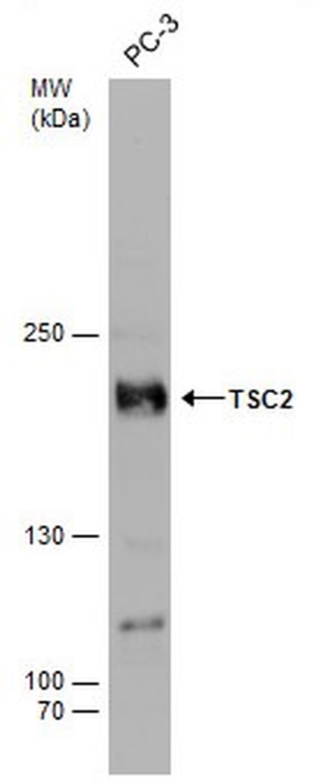 Phospho-TSC2 (Ser939) Antibody in Western Blot (WB)