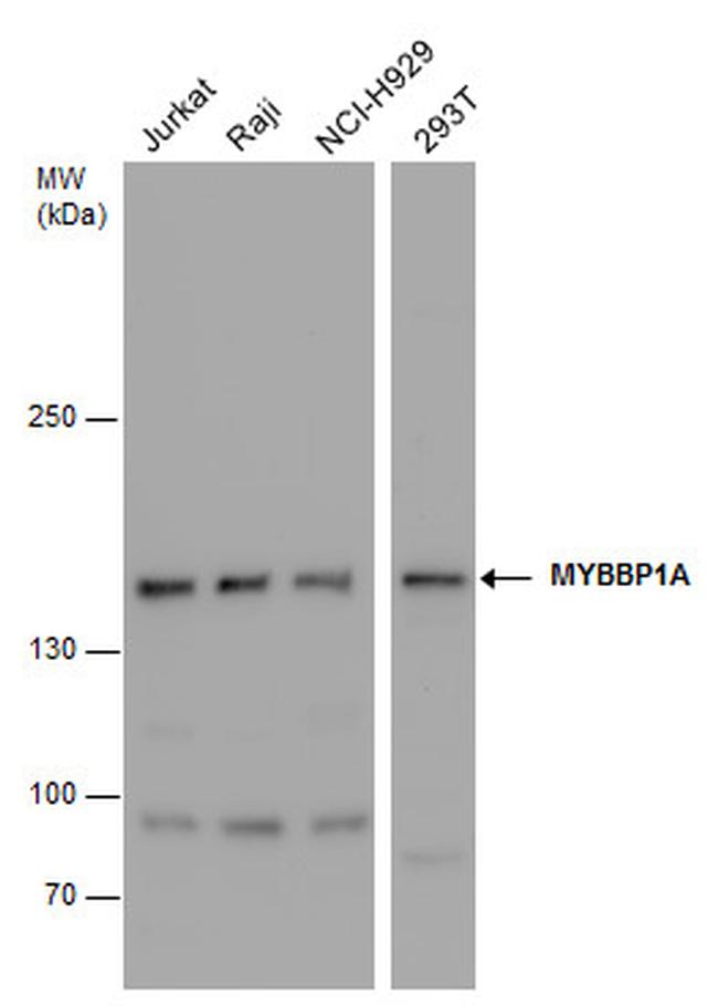 MYBBP1A Antibody in Western Blot (WB)