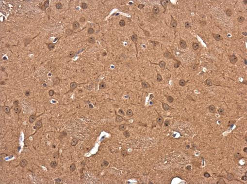 DIAPH3 Antibody in Immunohistochemistry (Paraffin) (IHC (P))