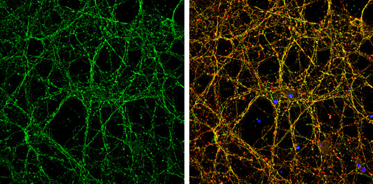 Nectin 1 Antibody in Immunocytochemistry (ICC/IF)
