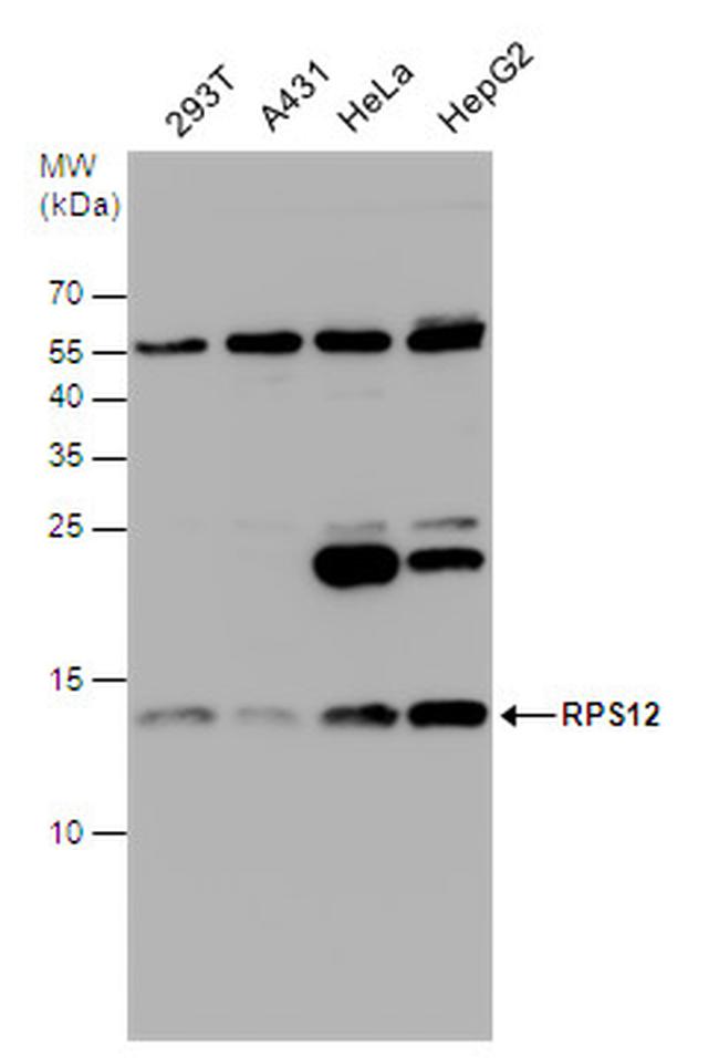 RPS12 Antibody in Western Blot (WB)
