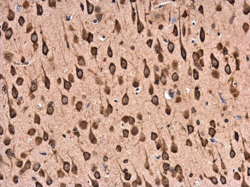 RPL22 Antibody in Immunohistochemistry (Paraffin) (IHC (P))