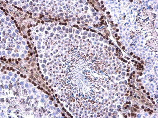 WAC Antibody in Immunohistochemistry (Paraffin) (IHC (P))