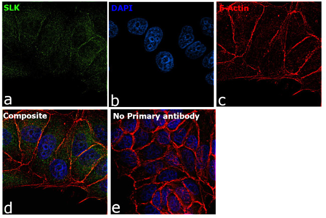 SLK Antibody in Immunocytochemistry (ICC/IF)