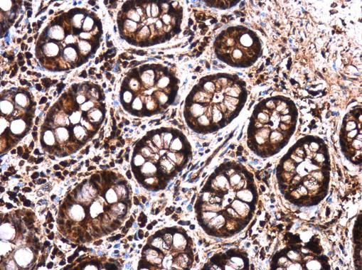LIN28B Antibody in Immunohistochemistry (Paraffin) (IHC (P))
