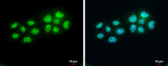BARD1 Antibody in Immunocytochemistry (ICC/IF)