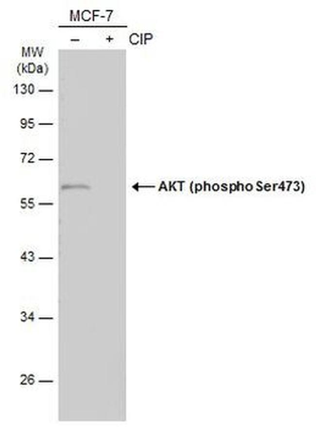 Phospho-AKT1 (Ser473) Antibody in Western Blot (WB)