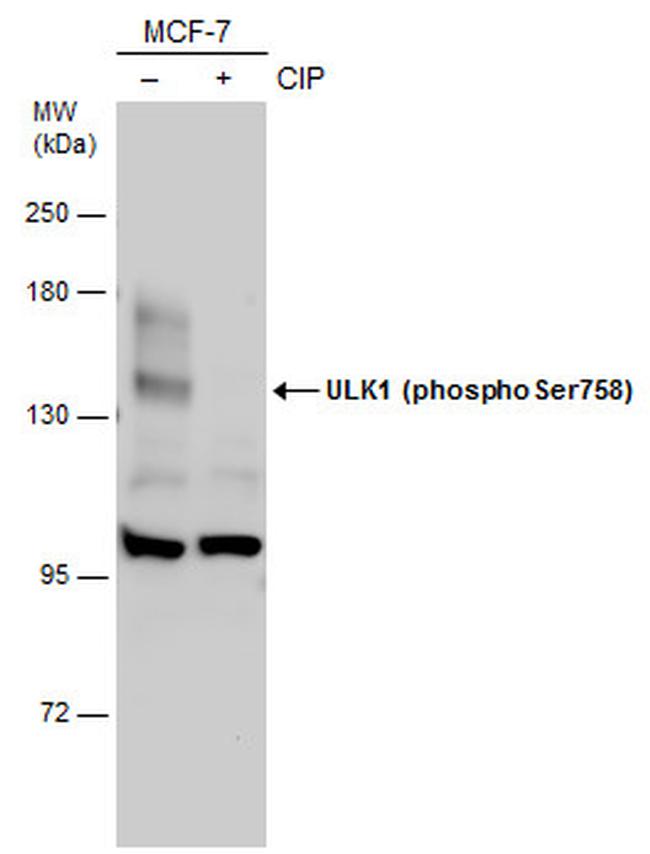 Phospho-ULK1 (Ser758) Antibody in Western Blot (WB)
