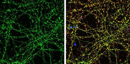 SLC6A4 Antibody in Immunocytochemistry (ICC/IF)