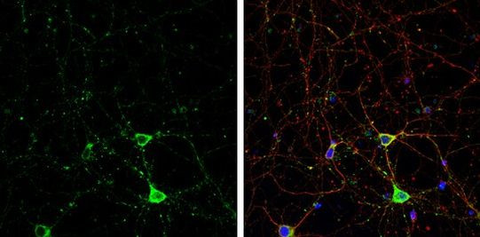 IP3 Receptor 1 Antibody in Immunocytochemistry (ICC/IF)
