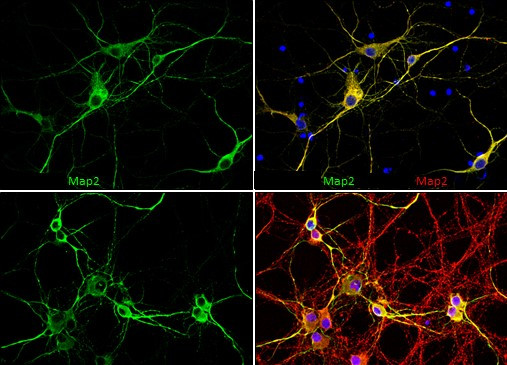MAP2 Antibody in Immunocytochemistry (ICC/IF)