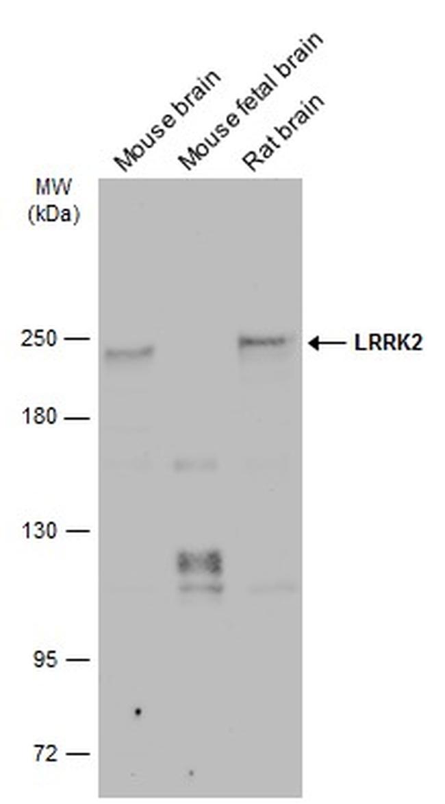 LRRK2 Antibody in Western Blot (WB)